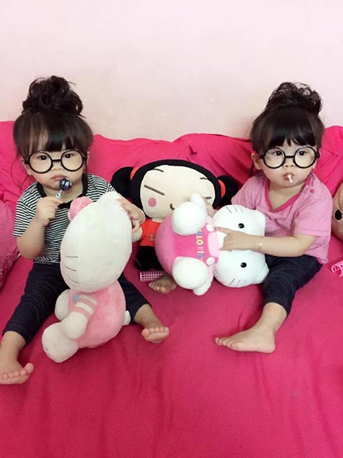 hai co nhoc song sinh dang yeu tua bup be dang khien dan tinh 