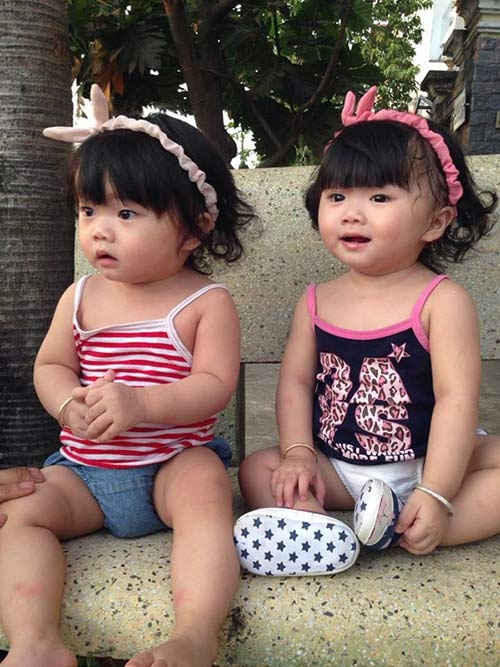 hai co nhoc song sinh dang yeu tua bup be dang khien dan tinh 
