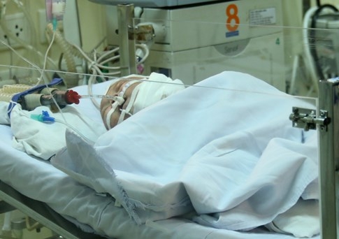 Việt Nam cắt thành công bướu quái cực hiếm, là ca thứ 2 trên thế giới - ảnh 4