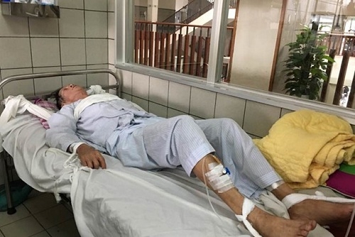 Người đàn ông say rượu chọc hỏng mắt vợ và cuộc 