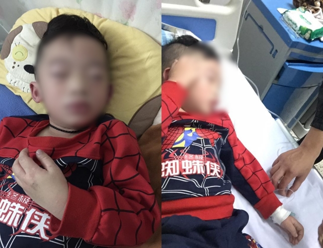 Hà Nội: Bé trai bị sưng vù mặt và tay sau khi uống trà sữa phải nhập viện cấp cứu gây xôn xao - Ảnh 2.