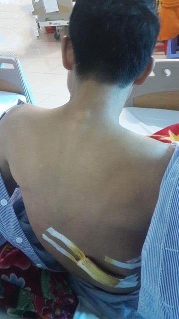 Lời kể nhân chứng vụ thanh niên cứu người lại bị đâm