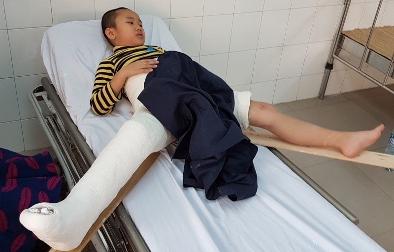 tai nạn trường tiểu học nam trung yên, học sinh gãy chân, trường nam trung yên, cô hiệu trưởng, tạ thị bích ngọc