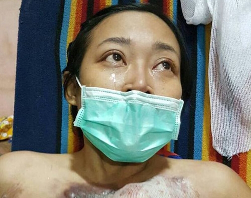 ung thu 1