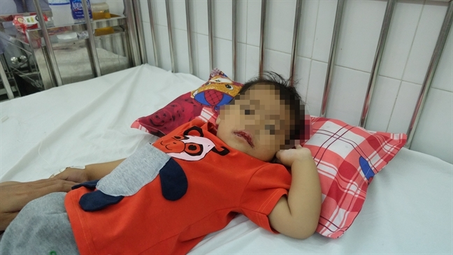 Theo me den cho lam thue, chau be bi trung doc