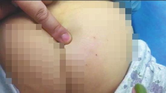 Cô giáo trường mầm non chất lượng cao bị đình chỉ dạy vì đâm kim vào mông học sinh - Ảnh 1.