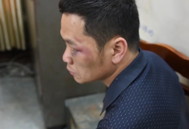 Tai xe Fortuner cho 100 banh heroin bi khoi to hinh anh 1