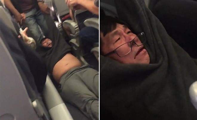 Be boi United Airlines: Ong David Dao co pham luat hay khong? hinh anh 1