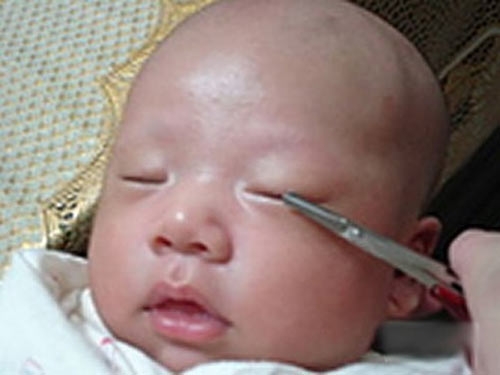 nguoi me soc nang khi biet nguyen nhan mat con nho sung hup, chay mu - 2