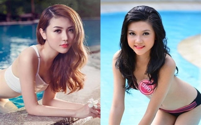 Hoa hau Hoa binh Quoc te duoc phep nhan thi sinh phau thuat tham my tai Viet Nam?
