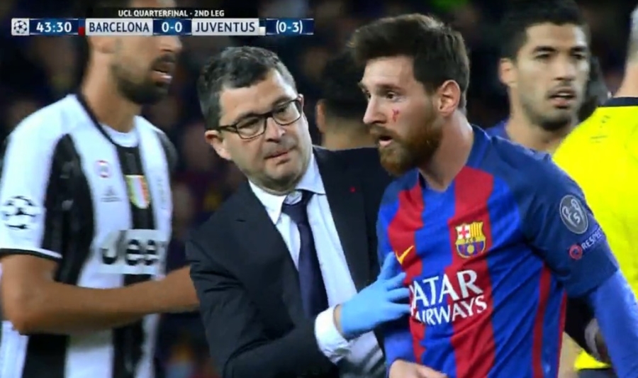 Messi nga lon co, dap mat xuong san va chay mau hinh anh 4
