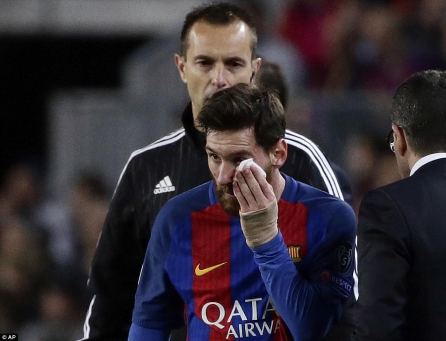 Messi nga lon co, dap mat xuong san va chay mau hinh anh 5