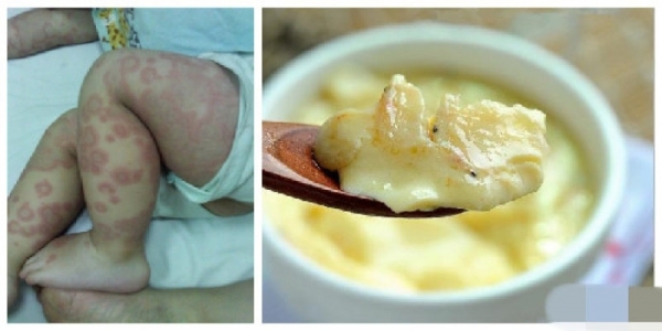 thay chau ha mieng nen ba cho an vai thia trung, it phut sau phai nhap vien khan cap - 4