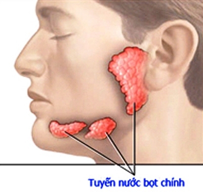 dau-hieu-canh-bao-ban-bi-ung-thu-tuyen-nuoc-bot