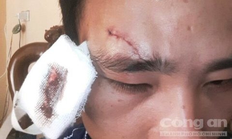 Nổi máu côn đồ giáo viên đánh đồng nghiệp toác đầu - Ảnh 1.