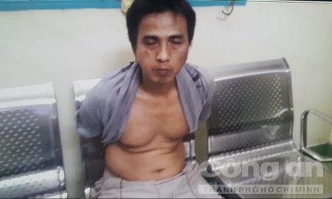 Hiep si Minh Tien bi phoi nhiem HIV khi truy bat ten cuop lieu linh hinh anh 1