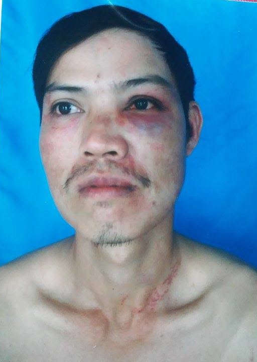 nguoi “tu dap dau xuong ban” tai ca phuong tung tin that thiet? hinh anh 1
