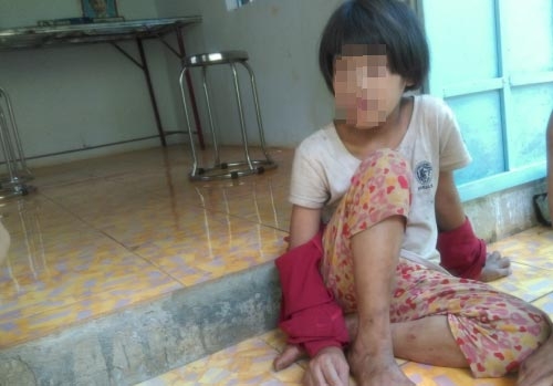 cuọc sóng hiẹn tại dáng thuong cua be gai tung bi me cat gan chan hinh anh 1
