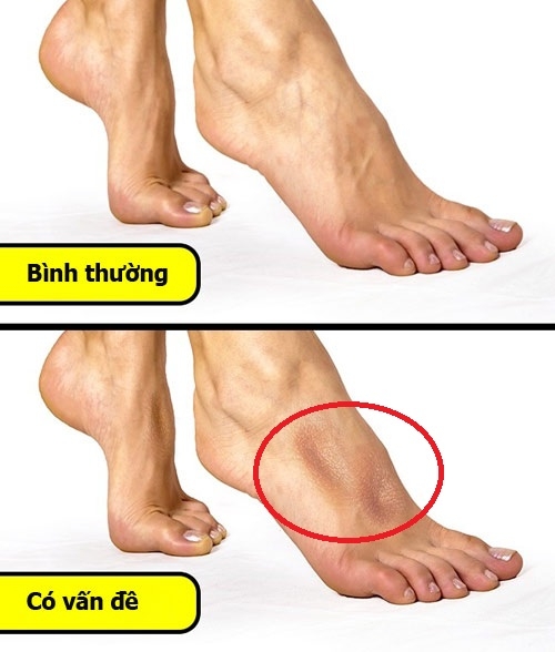 7 bai kiem tra don gian de danh gia suc khoe cua ban - 6