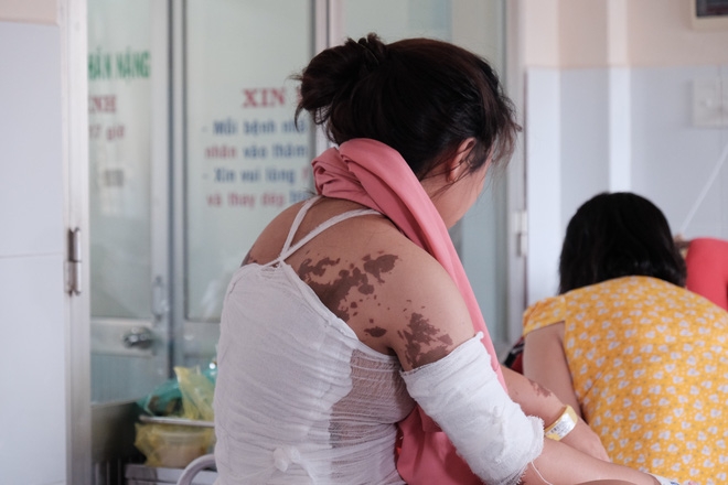 Vụ tạt axit ở Đồng Nai: Cô gái mâu thuẫn trực tiếp với người tạt axit có nguy cơ bị mù - Ảnh 8.