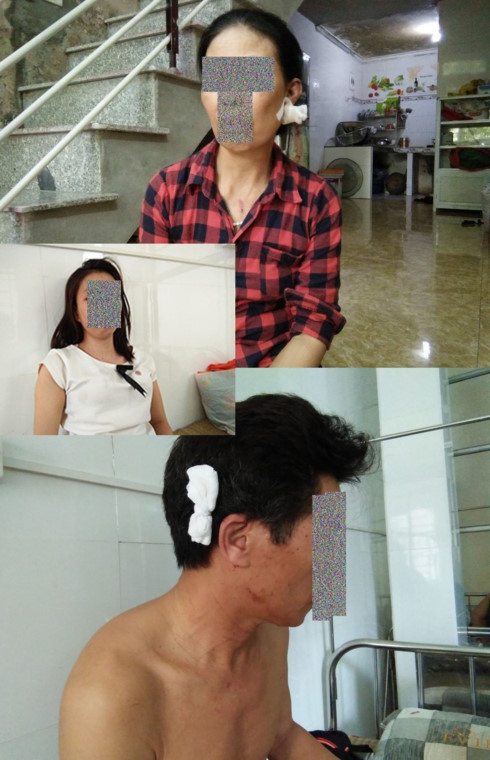 sau va cham giao thong, thanh nien hung han tan cong mot gia dinh hinh anh 2