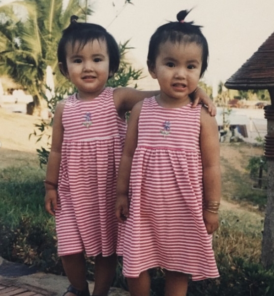 Lo dien em gai song sinh dep nhu hot girl cua Truc Anh The Face hinh anh 3