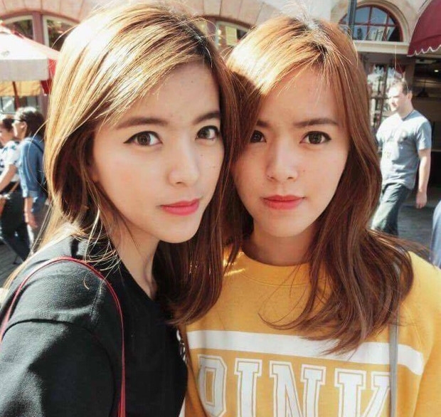 Lo dien em gai song sinh dep nhu hot girl cua Truc Anh The Face hinh anh 5