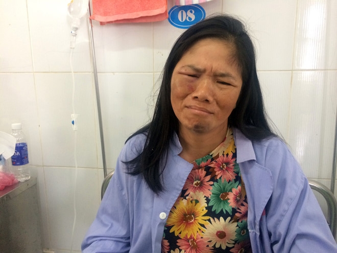 2 phu nu ban tam quyet lam ro dung sai sau vu bi danh nhap vien hinh anh 1