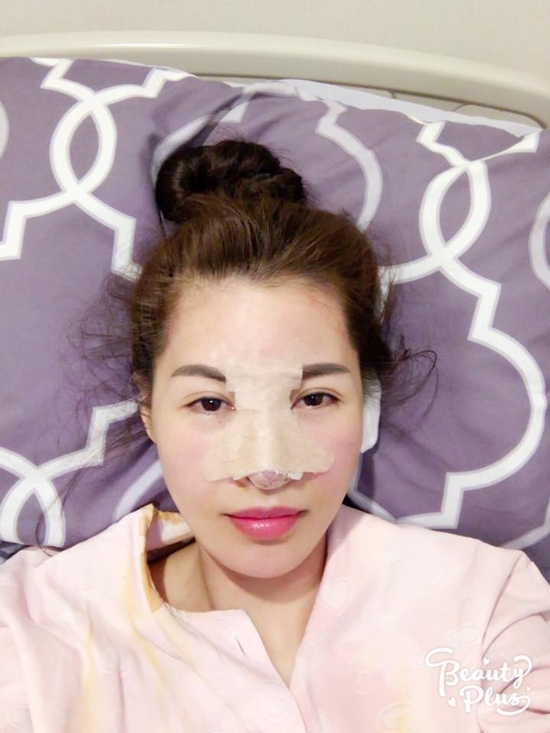 sao việt, mỹ nhân việt, sao phẫu thuật thẩm mỹ, ảnh dao kéo của sao, mỹ nhân việt phẫu thuật thẩm mỹ, phi thanh vân 