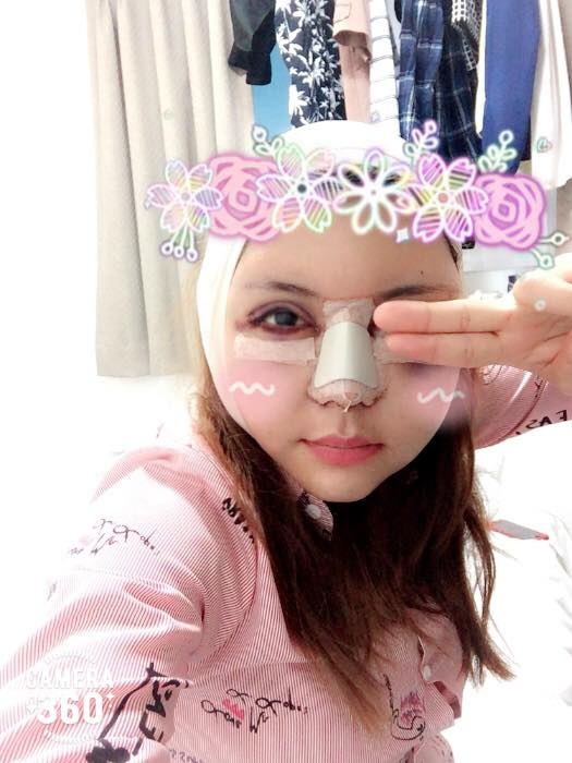 sao việt, mỹ nhân việt, sao phẫu thuật thẩm mỹ, ảnh dao kéo của sao, mỹ nhân việt phẫu thuật thẩm mỹ, phi thanh vân 