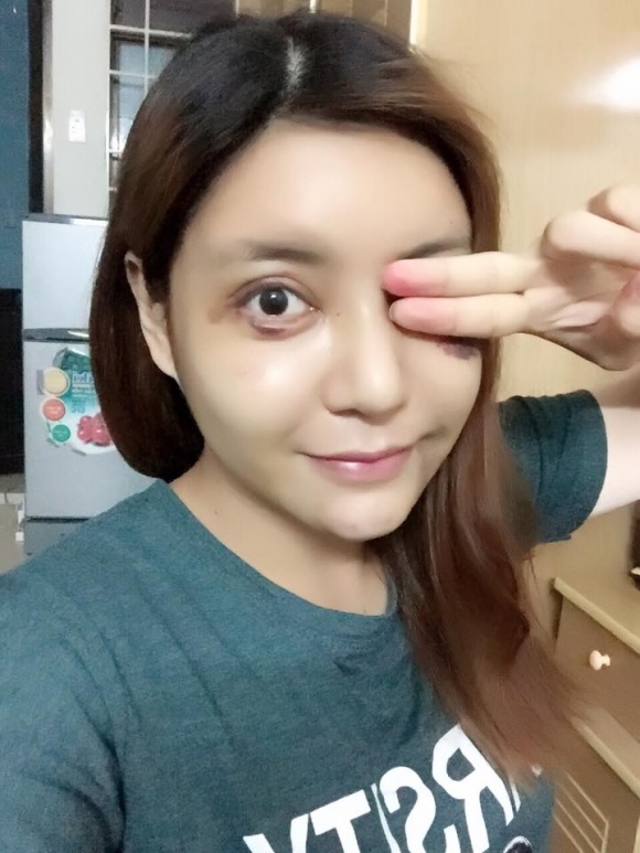 sao việt, mỹ nhân việt, sao phẫu thuật thẩm mỹ, ảnh dao kéo của sao, mỹ nhân việt phẫu thuật thẩm mỹ, phi thanh vân 