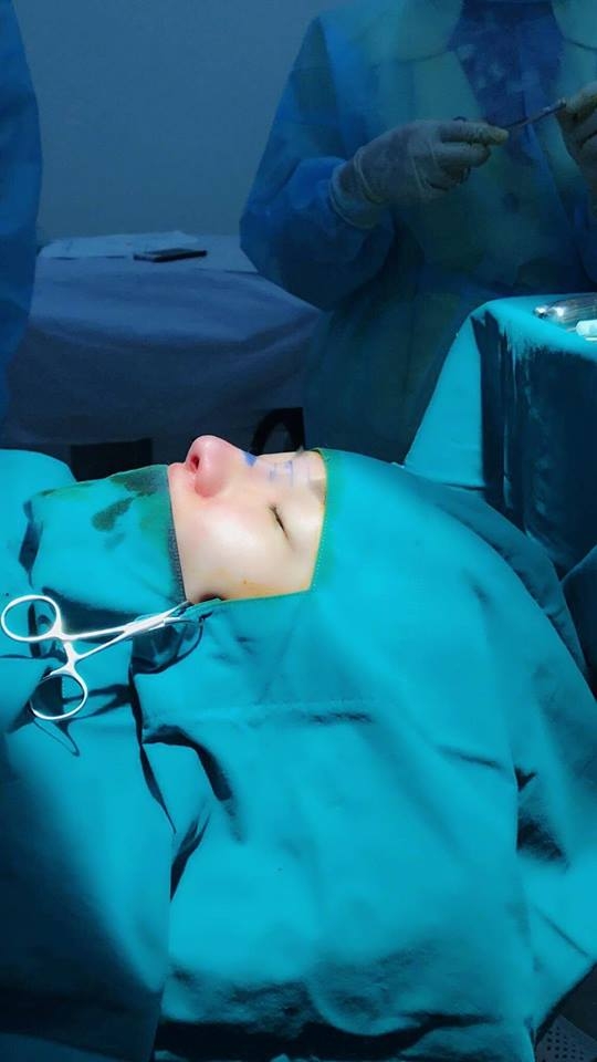 sao việt, mỹ nhân việt, sao phẫu thuật thẩm mỹ, ảnh dao kéo của sao, mỹ nhân việt phẫu thuật thẩm mỹ, phi thanh vân 