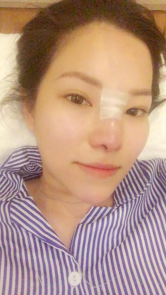 sao việt, mỹ nhân việt, sao phẫu thuật thẩm mỹ, ảnh dao kéo của sao, mỹ nhân việt phẫu thuật thẩm mỹ, phi thanh vân 