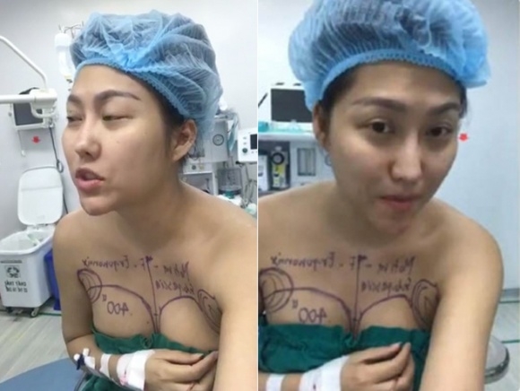 sao việt, mỹ nhân việt, sao phẫu thuật thẩm mỹ, ảnh dao kéo của sao, mỹ nhân việt phẫu thuật thẩm mỹ, phi thanh vân 
