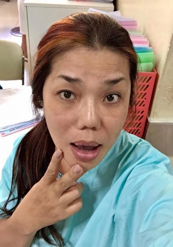 sao việt, mỹ nhân việt, sao phẫu thuật thẩm mỹ, ảnh dao kéo của sao, mỹ nhân việt phẫu thuật thẩm mỹ, phi thanh vân 