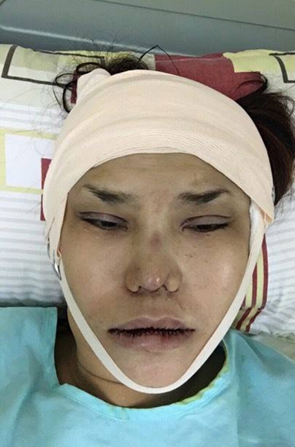 sao việt, mỹ nhân việt, sao phẫu thuật thẩm mỹ, ảnh dao kéo của sao, mỹ nhân việt phẫu thuật thẩm mỹ, phi thanh vân 