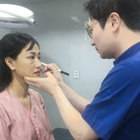 sao việt, mỹ nhân việt, sao phẫu thuật thẩm mỹ, ảnh dao kéo của sao, mỹ nhân việt phẫu thuật thẩm mỹ, phi thanh vân 