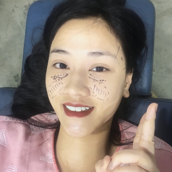 sao việt, mỹ nhân việt, sao phẫu thuật thẩm mỹ, ảnh dao kéo của sao, mỹ nhân việt phẫu thuật thẩm mỹ, phi thanh vân 
