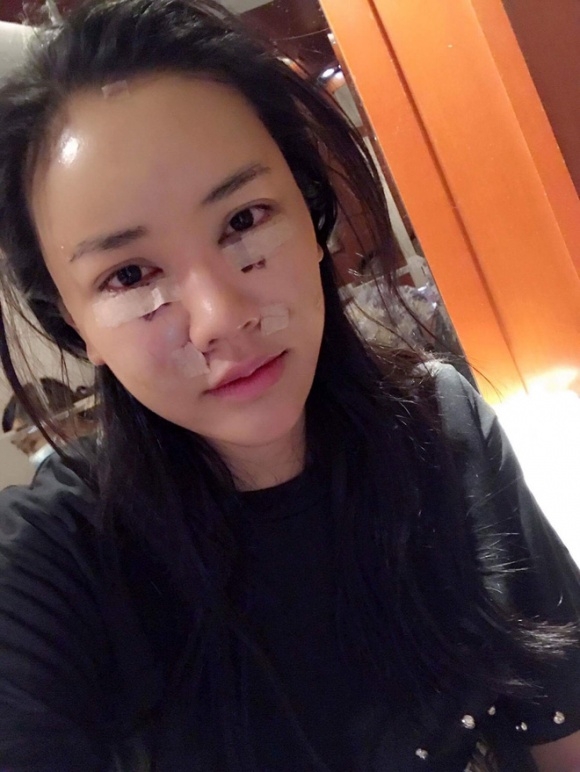 sao việt, mỹ nhân việt, sao phẫu thuật thẩm mỹ, ảnh dao kéo của sao, mỹ nhân việt phẫu thuật thẩm mỹ, phi thanh vân 
