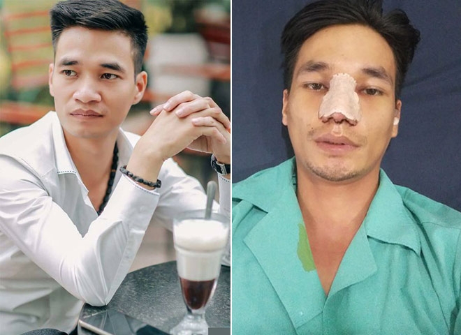 le roi thao bang mui, lo dien hinh anh dep nhu soai ca hinh anh 1